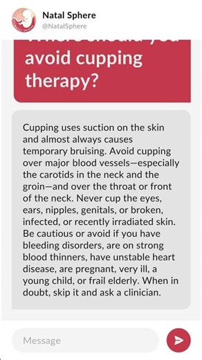 Where should you avoid cupping therapy?