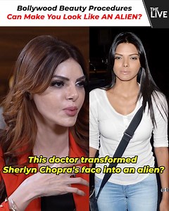 96K views · 207 reactions | Sherlyn Chopra Started Looking Like An ALIEN after Doctor RUINED Her Life! Sherlyn Chopra has opted for many beauty procedures in the past. She shares her shocking story of what went wrong. | The Live | Facebook