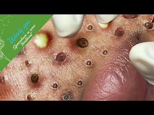 Make Your Day Relaxing with Windy Spa 6#82