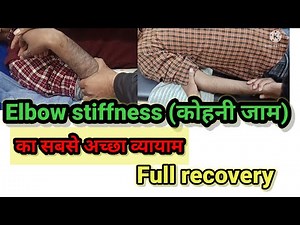 #Elbow stiffness physiotherapy exercises#post operative elbow joint exercise