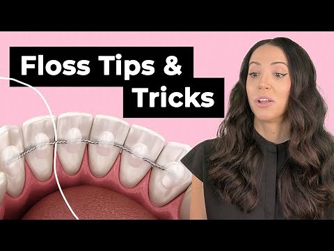 Flossing Tricks for Permanent Retainers (Cleaning Bonded-Retainers Properly)