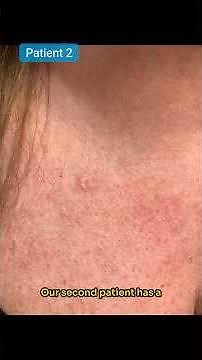 Dermoscopys primary purpose is ...