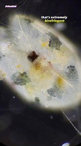 Ostracod aka Seed Shrimp #undermicroscope #microscopy #microscopic #microcosmos #microworld #microto | Closeintel