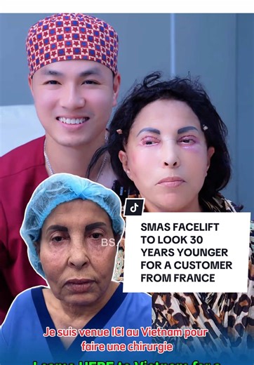 SMAS Facelift: Rejuvenate Your Look by 30 Years