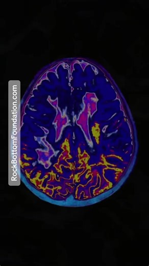 Understanding Emotional Amnesia at Rock Bottom