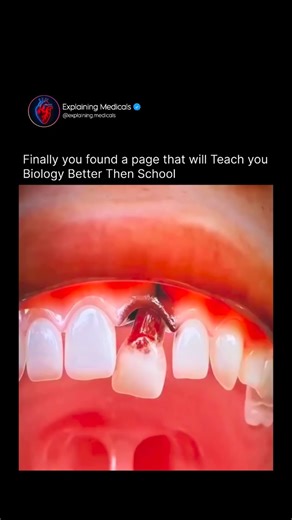 Medical | Health | Anatomy on Instagram: "Many people think swallowing a broken tooth is dangerous… but actually, in most cases it passes safely through the digestive system and comes out naturally in the poop because the tooth is hard, non-toxic, and the stomach cannot digest it, so it simply travels through the intestines like any small solid object and exits without harming the body; only very sharp, large, or metallic dental parts may rarely cause issues, but a normal broken tooth usually do