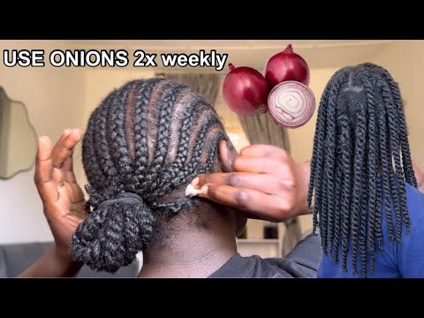 USE ONIONS 2x Weekly/ ONIONS FOR FAST HAIR GROWTH .