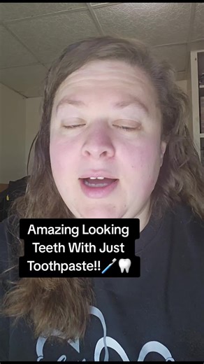 BodyAccel Toothpaste #toothpaste #teethtok #bodyaccel #whiteteeth #niacinamidetoothpaste