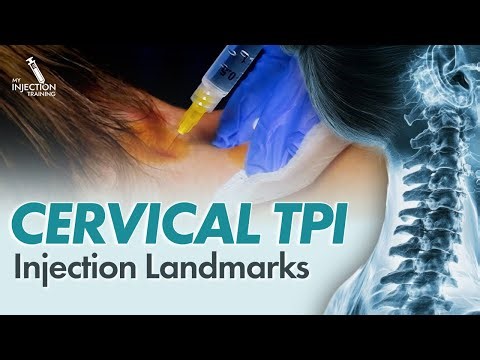 How to Perform Cervical Paraspinal Trigger Point Injections