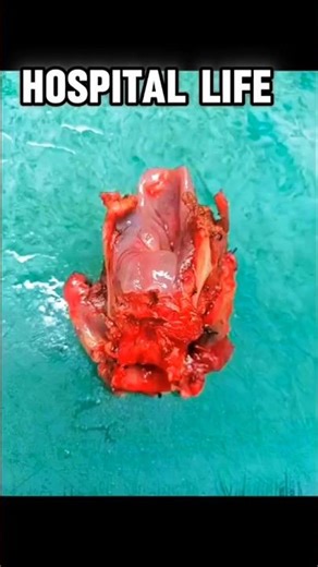 process of histopathology lab.#labtechnician lab life hospital life