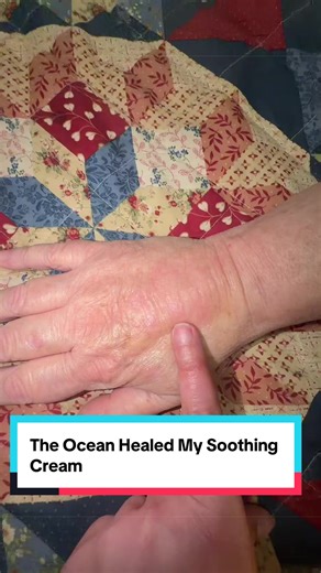 This wasn’t even for me… it was for my mom. She has plaque psoriasis on her hand, and if you’ve ever seen that up close, you know; it’s not just dry skin. It’s constant irritation, itching, and that feeling like your skin just won’t calm down. I put this cream on her hand not expecting much… but within minutes, she said the itching stopped. After just a few applications, her skin started looking less angry, more hydrated, and actually soothed. Not covered up; calmed down. This soothing cream is 