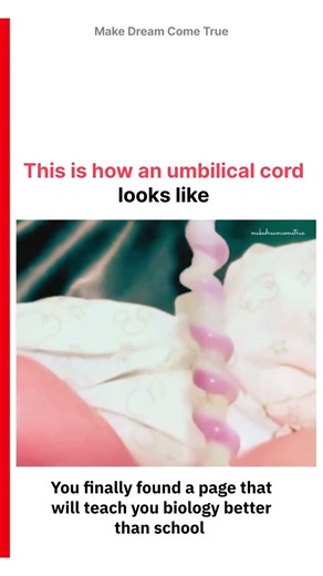 🧬 This is how an umbilical cord looks like ✂️ | MDCT