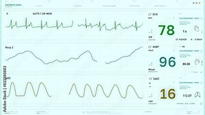 Computer health monitoring system is examining the pulse. Computer pulse monitoring system is tracking the vital health signs of a patient. Computer is monitoring the pulse of the ill person. EKG.