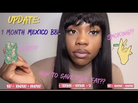UPDATE: 1 MONTH MEXICO BBL | Q&A: MY DOCTOR, COST, BEFORE & AFTER | Maya Shantell🎀