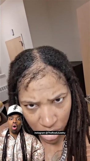 If this happens to your dreadlocks get rid of them immediately