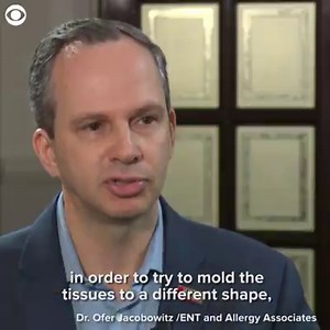 27K views | A new treatment is helping patients who struggle with nasal obstruction or congestion get some relief without invasive surgery. | CBS Newspath | Facebook