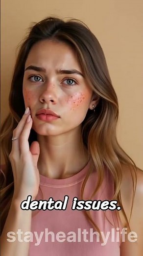 Stop Pimples! Know the Reason by Face Area
