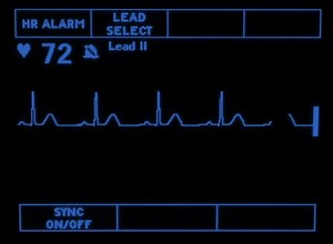 clip-6788431-simulated-monitor-showing-normal-sinus-rhythm