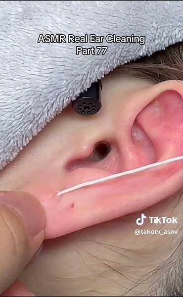 ASMR Ear Cleaning: Real Sounds and Techniques Part 77