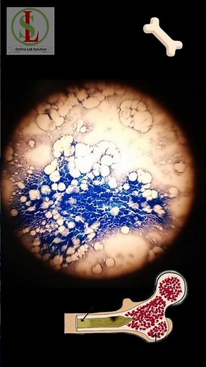 Red Bone 🦴 Marrow smear under Microscope
