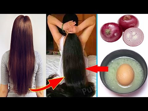 How To Grow Long and Thicken Hair Faster With Onion & Egg | Magical Hair Growth Treatment 100% Works