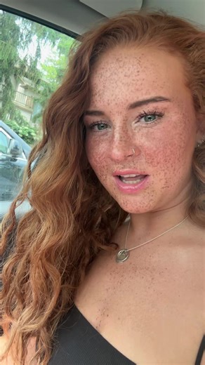 Celebrating Freckles: Ginger Style Inspiration