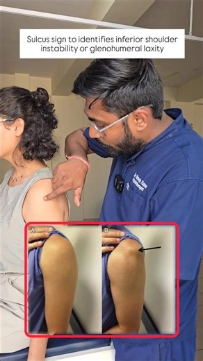 Sulcus Sign Test 👇 to identify inferior shoulder instability & shoulder dislocation #physiotherapy