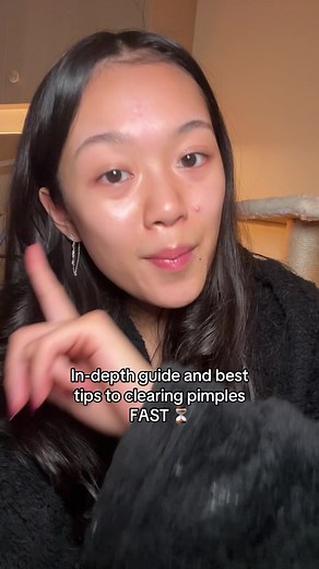 Expert Guide to Clearing Pimples Fast