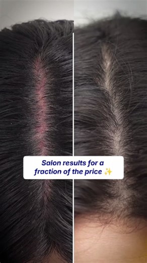 COCOMO® www.cocomo.sg on Instagram: "“This came out of my scalp?! 😳👇” Thought my shampoo was enough… until I tried the #Forbeaut #HyperDeep #CleansingScalpScaler. 🫧 Melts flakes, oil & buildup with micro-oxygen bubbles 🧪 Panthenol, Salicylic Acid & Niacinamide = deep cleanse + calm 💆‍♀️ Feels like a scalp facial — no scrubbing needed ⚠️ Try it once… you’ll never trust your shampoo again. 🔥 Launching Tomorrow @ 12 PM!"