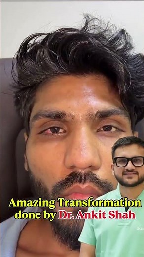 Esotropia Inward Eye Squint Surgery Explained by Dr Ankit Shah Causes & Treatment