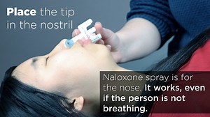 1K views · 22 reactions | Do you know how to administer Naloxone?...