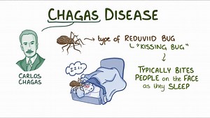 Video: Trypanosoma cruzi (Chagas disease) - Video Explanation! | Osmosis | Osmosis