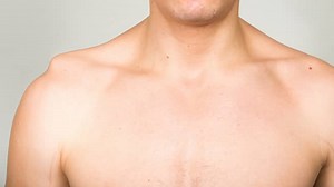 Early Repair of Shoulder AC Joint Key to Recovery