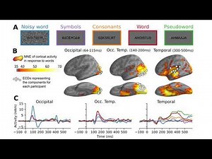 A large scale computational model of visual word recognition and its comparison to MEG data