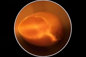 Ocular alien implant, magnified.