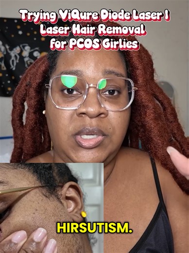 I finally tested @ViQure Diode Laser on my sideburns for my PCOS Hirsutism, and y'all I'm not gonna lie, the sideburns sting LOL I'll be continuing to use the device on my sideburns every month, and I'll be trying it on my chin next month - I'll keep y'all updated! Disclaimer: I did receive this item gifted from ViQure, and any opinion I provide is my own! #hirsutism #laserhairremoval #diodelaser #pcosproblems #pcos