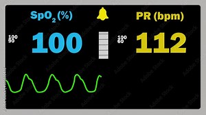 Pulse oximetry monitoring equipment screen - value of SpO2, saturation waveform and Pulse rate in one screen