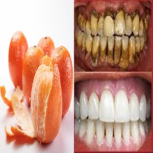4.2K views · 73 reactions | Just peel the orange and rub the white part of the peel over your teeth. Let the juice sit on your teeth for 3-4 minutes before brushing if off to remove the pulp and peel. But, make sure that the orange is thoroughly washed before peeling to remove dirt. | Health Tips | Facebook