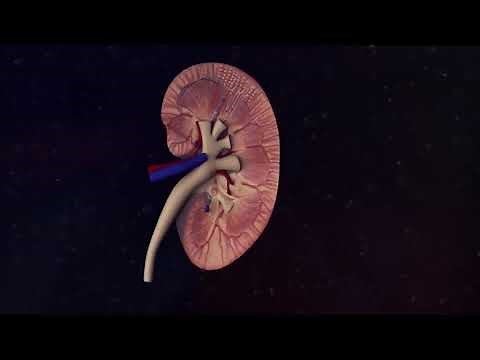 Management of Hyperkalemia in Patients With Hemodialysis-Dependent CKD