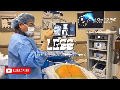 LESS: Facet Cyst Removal