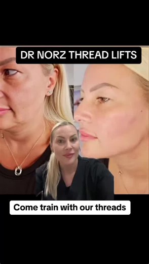 Training with DR NORZ: Mastering Thread Lift Techniques