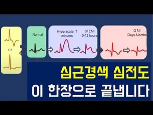 10강 - 이 한장으로 심근경색 심전도를 이해하게 됩니다