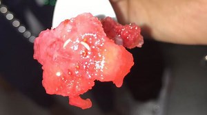 Maggot-infested strawberries served to Cy-Fair students