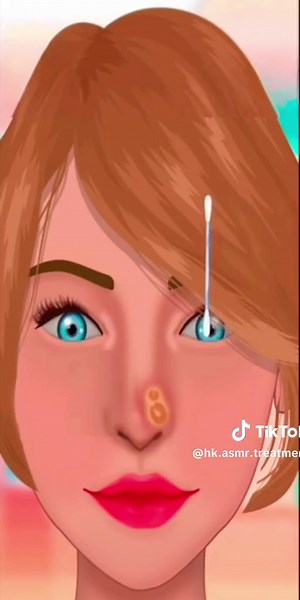ASMR nose piercing infection Treatment | clean nose piercing 2d animation video HabibkhanASMRtreatment clean nose piercing & mucus #asmr #2danimation #2d #nosetreatment #nosepiercing #noseclean #treatment #asmrvideo #asmrsounds #animation #treatment #ASMRanimation #health #sleeping #ASMRsound #skincare #care #treatmentanimation #2d #2danimation #ASMRdokter #bodycare #HKanimation #animationvideo #treatmentvideo #Hkcare #HKASMRtreatment #HKCARE #HABIBKHANASMR #ASMRvideo #sleepingsound #HKtreatment