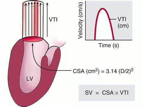 20251114 Basic cardiac ECHO Part 2