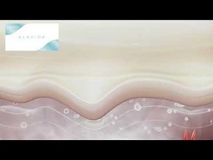 Alavida - Patch Placements - Learn To Patch LifeWave