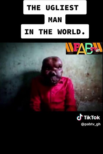 Godfrey Baguma: The World's Ugliest Man Story