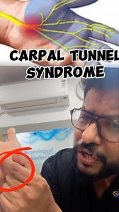 21K views · 2.7K reactions | Carpal Tunnel Syndrome try this test  try an inverted namastae and see the sensation .Take breaks to stretch ⏰, maintain good posture ‍♀️, and consider a wrist splint at night . If symptoms persist, consult a healthcare professional ‍⚕️.#drramphysio #hand #fingers #numbness #exercise #nerve | Dr.ramphysio | Facebook