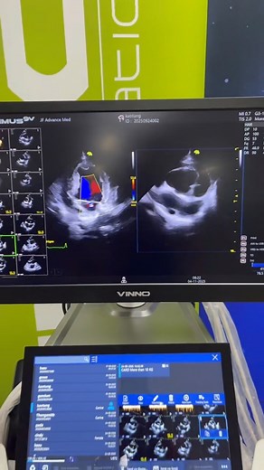 วันนี้กับ🎊สัมมนา Echocardiography🫀🫀#VINNOอัลตราซาวน์สำหรับสัตวแพทย์ ☘️📚 📚 โครงการฝึกอบรม MU-JF Basic Echocardiography for Practitioner จัดโดย JF ACADEMY ร่วมกับ คณะสัตวแพทยศาสตร์ มหาวิทยาลัยมหิดล 📚 หัวข้อโครงการฝึกอบรมเชิงปฏิบัติการ การใช้อัลตราซาวด์ในการตรวจหัวใจสุนัขขั้นพื้นฐาน🫀#VETMU #JFacademy 🎊 📍 จัดในวันที่ 4 - 5 พฤศจิกายน 2568 #JFเคียงข้างสัตวแพทย์ไทย #JFคุณภาพและความไว้วางใจ #JFครบรอบ30ปี 🎊 J. F. Advance Med We Purpose Quality and Trust สอบถามข้อมูลเพิ่มเติม ดังนี้ 📱 ติดต่อ : 