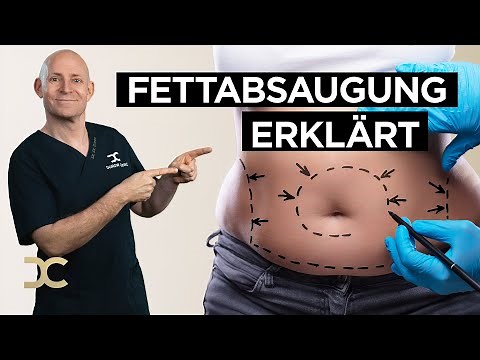 Liposuction: Procedure and risks explained simply